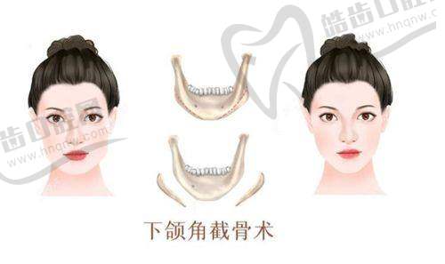 北京天使名源医院魏春华医生的坐诊优势