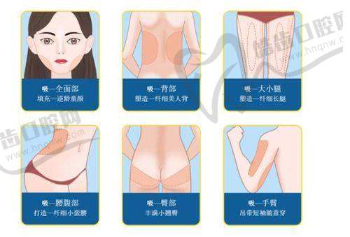 北京阎晓辉所在医院身体塑形的价格区间是多少