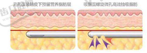 钟杰光医生医院的具体位置在广州白云区之常见问题提醒