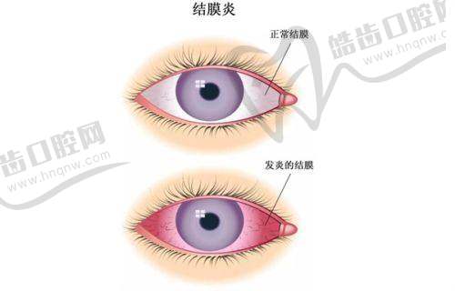 郑州爱尔眼科医院如何预约挂号？