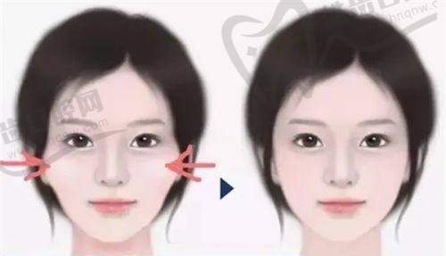 北京纯脂医疗美容冯斌医生医术评价之技术创新带领者