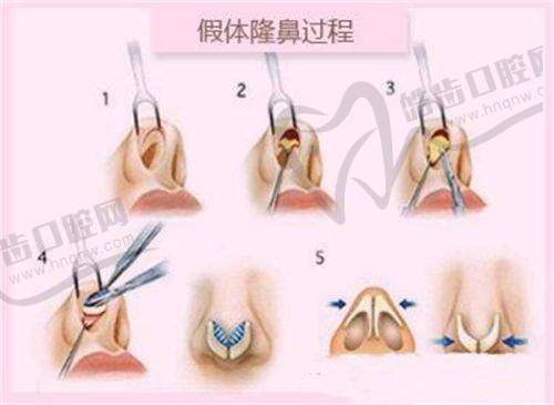 北京侯濤醫(yī)療美容診所項目價格詳情