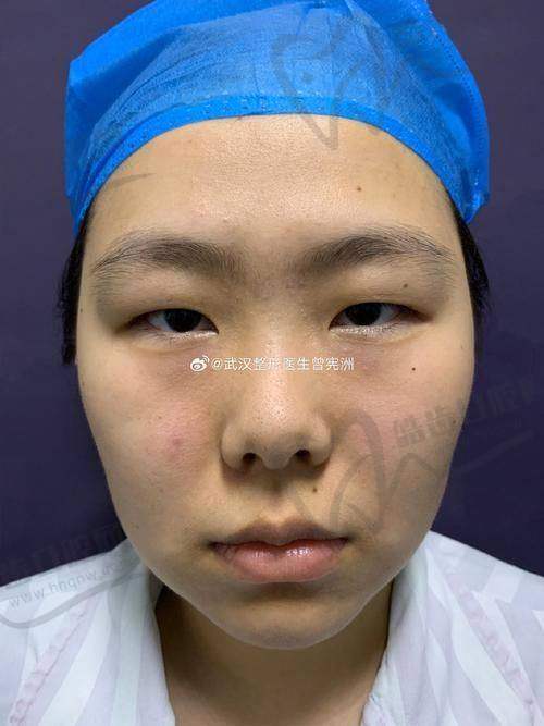 北京八大处整形医院的优势对栾杰医生眼部整形的影响