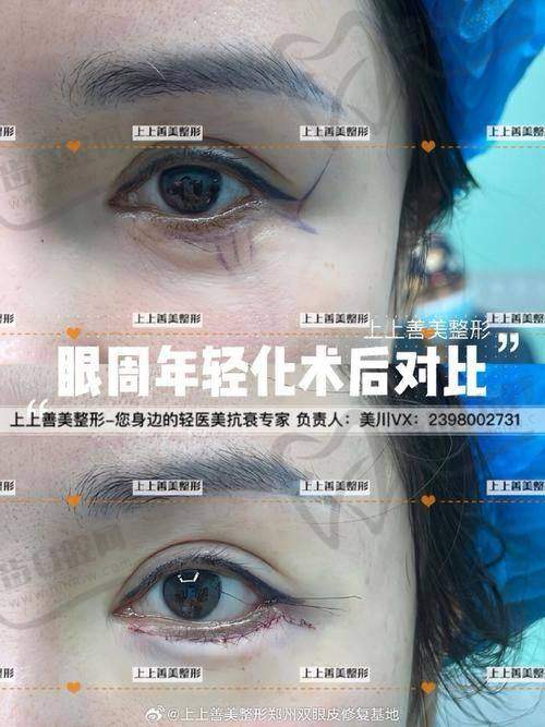 韩国PROPOSE整形医院收费价格表/收费标准