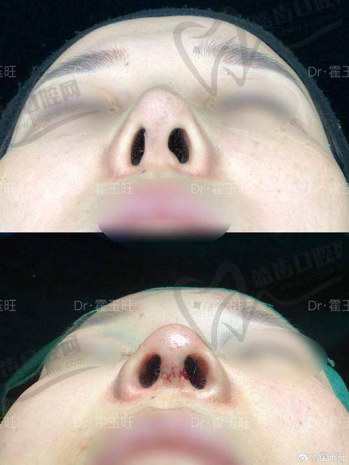 徐航医生的口碑评价与反馈情况