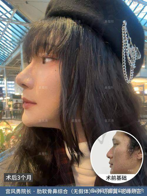 马永光医生擅长:多样医疗美容项目