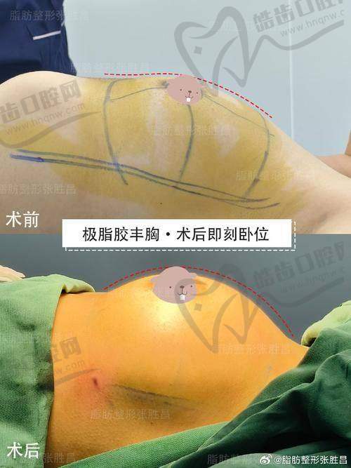 北京纯脂医疗美容门诊部常双明医生介绍