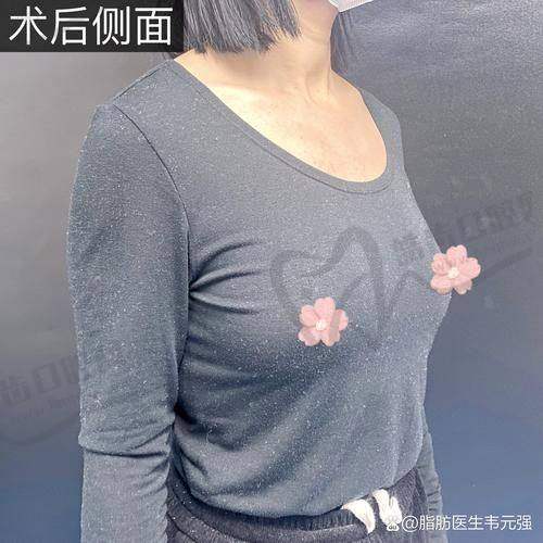 北京米兰柏羽丽都医疗美容医院特色及优势