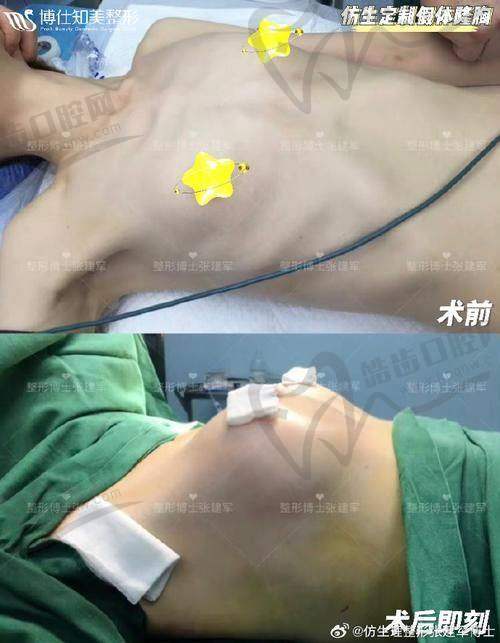 北京309医院整形美容科石冰医生