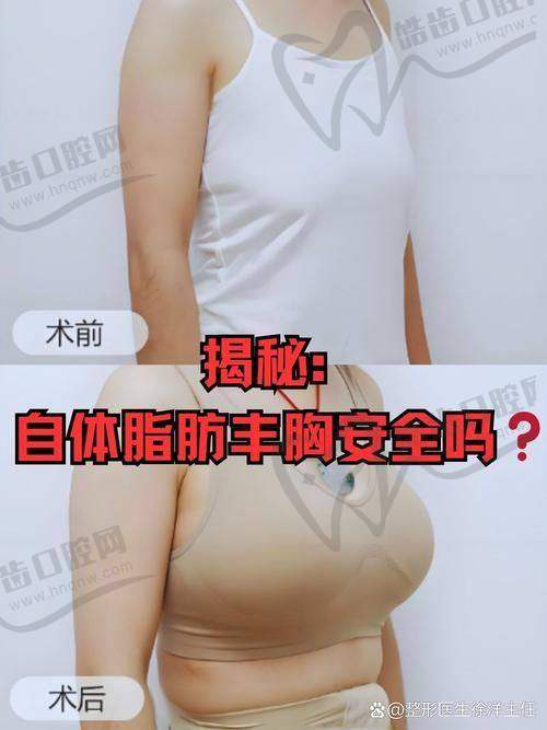 北京艺星医疗美容医院的服务流程与胸部整形体验