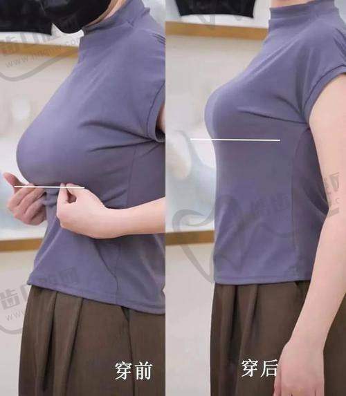 溫州藝星整形醫(yī)院地址與就診方式