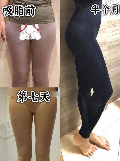 吴建明医生的个人资料简介