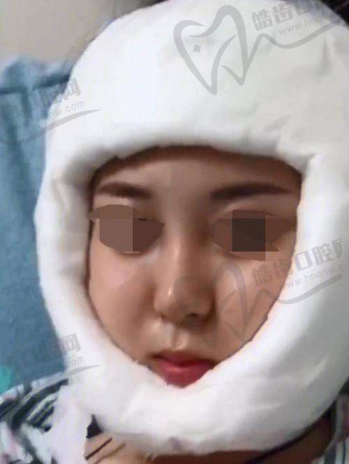 四川华西李运峰的号怎么联系？正颌、磨骨预约秘籍，让你不再迷茫！