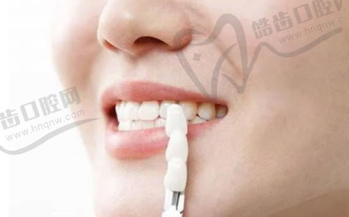 成都矫正牙齿价格一般多少？影响价格的因素