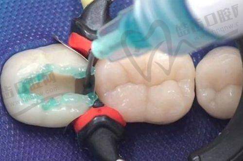 西双版纳拜尔口腔医院特色项目及技术优势