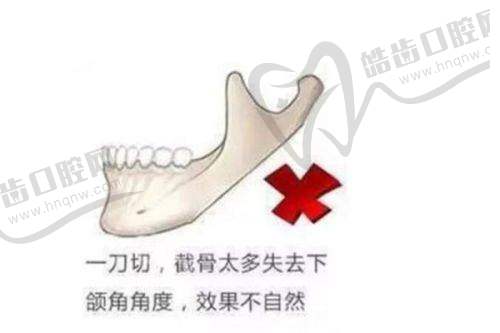 特定品牌黃金微針詳細(xì)對(duì)比分析