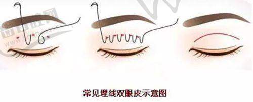 上海華美與潤致水光2ml項目相關(guān)其他類型的收費價格參考