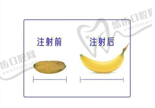 上海華美潤致水光2ml項目真人實例一