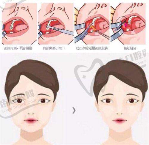 鄭小紅醫(yī)生口碑超棒的原因分析