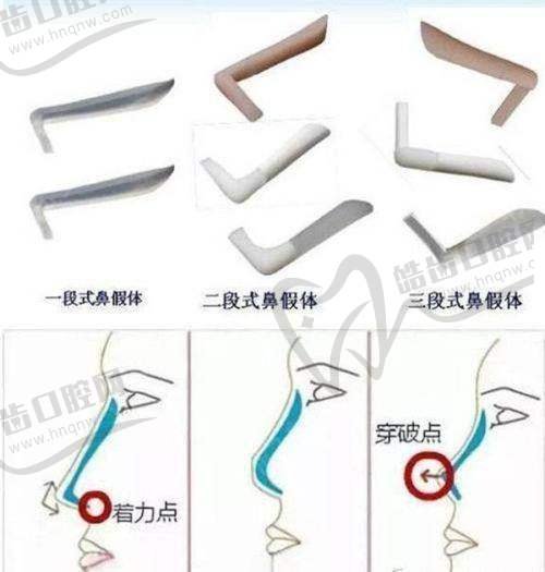 選擇潤致玻尿酸型號的建議及注意事項(xiàng)