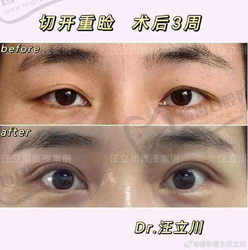 欧阳黎平医生擅长的整形项目