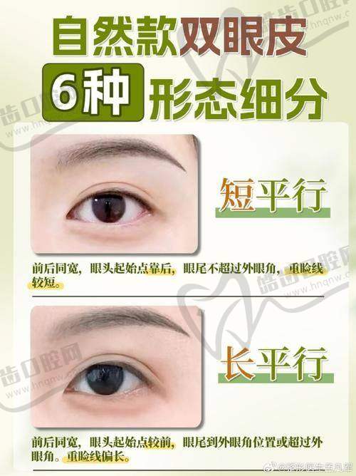 上海安禾美阁郑小红医生技术优势