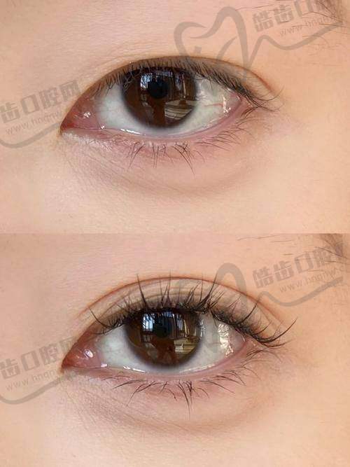 王冰医生独特的整形美容技术优势