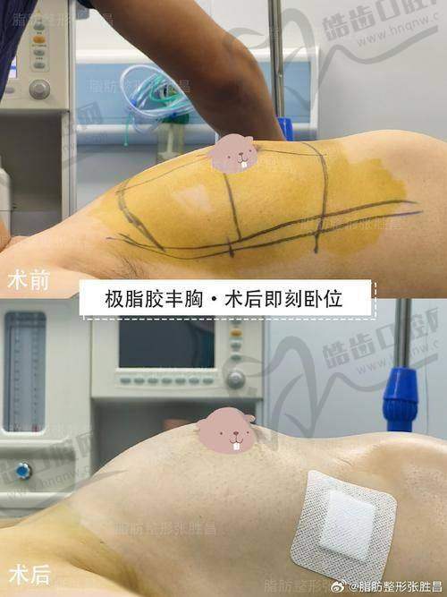 李迎锋医生丰富的个人资料简介