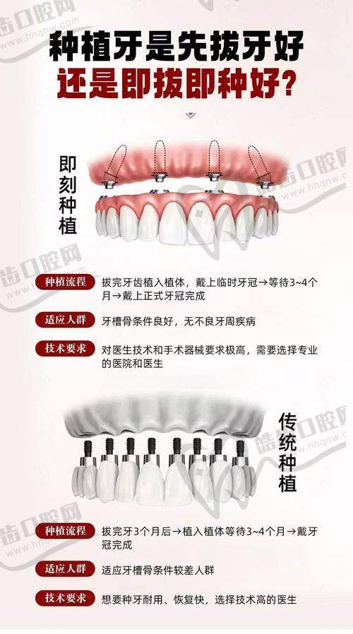 上海诺贝川口腔（惠齿口腔诊所）特色项目及技术优势