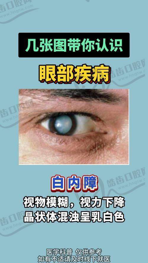 新疆医 科 大学中医学校眼科价格表