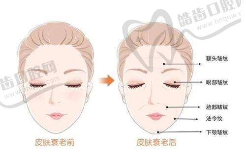 瑞蓝丽多玻尿酸与其他型号有什么区别？