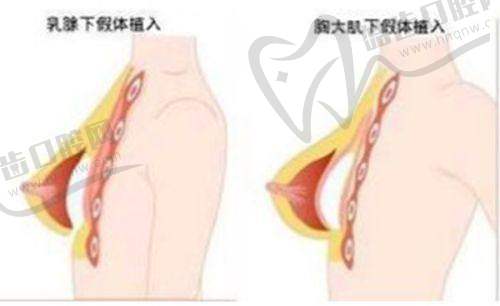 2025年瑞蓝丽多玻尿酸价格趋势预测