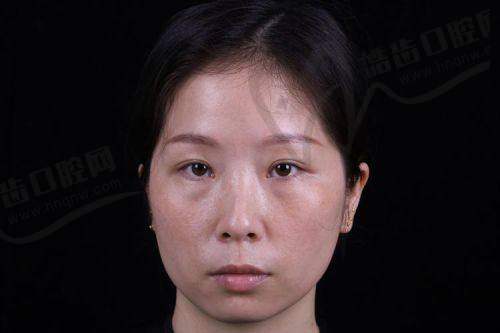 北京丁军 医生的技术优势亮点
