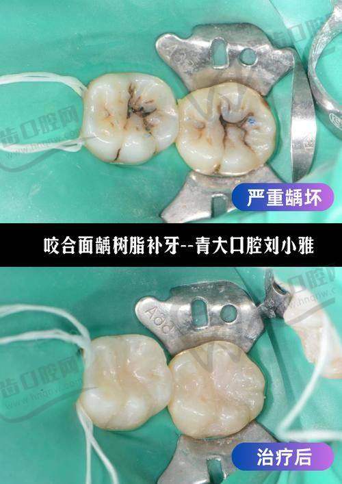 西安碑林海涛金花口腔门诊部（金花店）特色项目及技术优势
