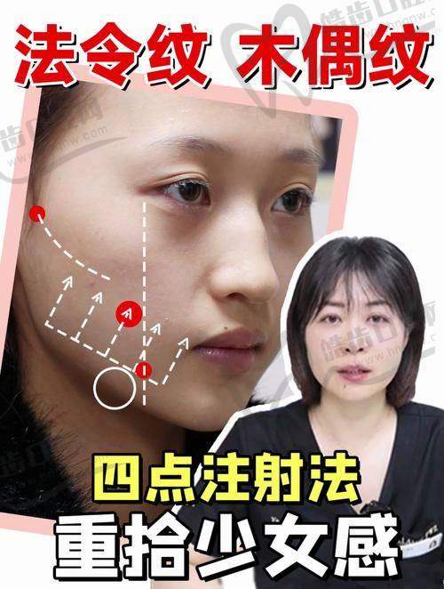 嗨體熊貓針與嗨體1.5針對(duì)人群差異與典型實(shí)例分析