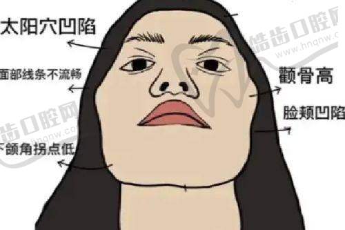 管连斌医生技术水平高