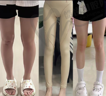 西安艺星曼芙佳0.75mL玻尿酸5980元起·徐智慧院长亲诊适合眼周轮廓填充