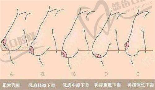 艾莉薇玻尿酸型号之风尚版