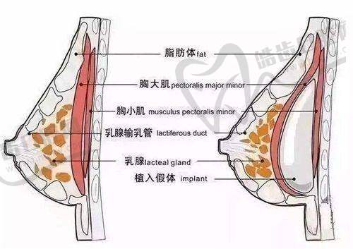 onda是什么医美项目之医院推荐