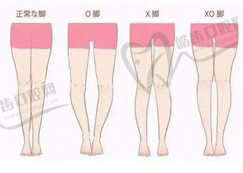 西安艺星润百颜黑金玻尿酸1mL|6份价格5999元起,四环美学骨相填充更自然