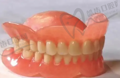 牙坏了千万别做牙套：牙套的潜在风险