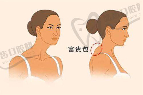 乔雅登玻尿酸正版价格的未来趋势
