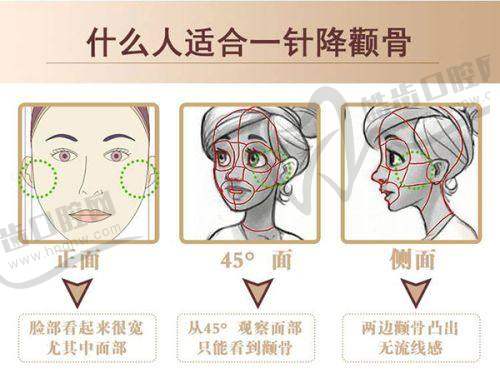 阿杜博士（外籍）价格表