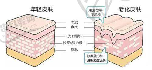 西安艺星润百颜黑金玻尿酸1mL|3份价格3280元起 高性价比黑金款适合面部轮廓填充