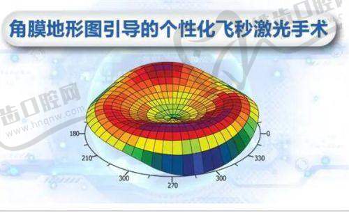 贵州晶朗眼科SMILE3.0全飞秒手术16899元起，德国蔡司定制告别近视！