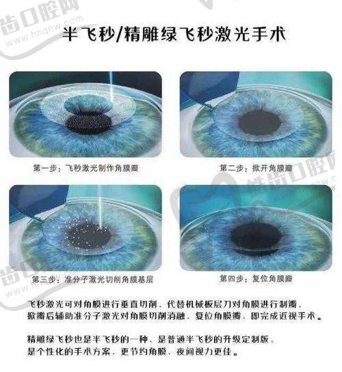 四、重庆南岸爱成眼科基本信息：