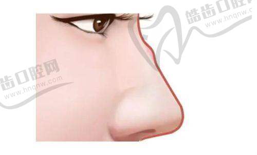 西安艺星第四代热玛吉面部900发12800元起,赵银巧医生亲诊正版仪器扫码验真抗衰成效显著