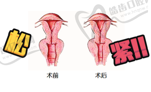 徐博琼医生预约挂号
