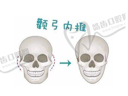 上海華美皮膚科醫(yī)生的專精優(yōu)勢(shì)