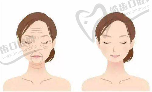 上海華美頜面整形醫(yī)生李志海介紹